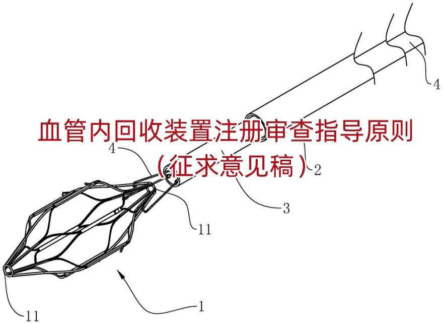 血管内回收装置注册审查指导原则（征求意见稿）