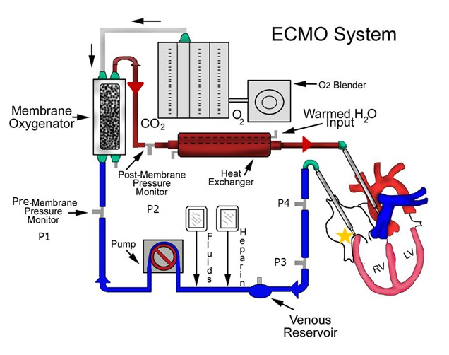 体外膜氧合（ECMO）循环套包研发实验要求与主要风险