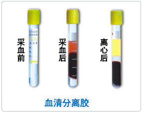 《一次性使用真空采血管产品注册审查指导原则（2023年修订版）》公开征求意见（附全文）