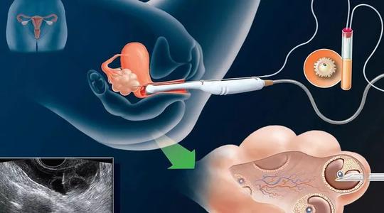 YY/T 1688-2021《人类辅助生殖技术用医疗器械 囊胚细胞染色和计数方法》行业标准解读