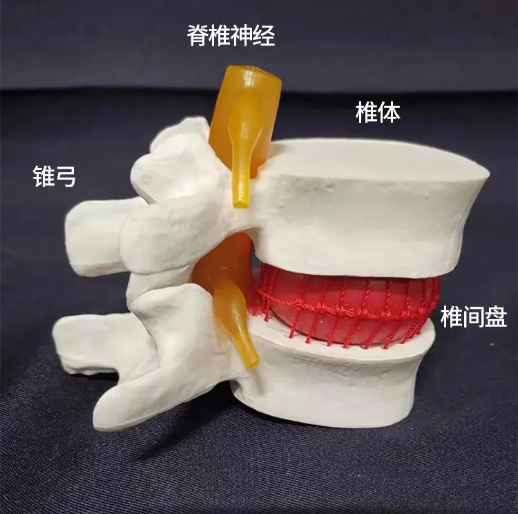 针对医用骨科（椎间融合器、椎间盘假体、椎体成形球囊）产品国抽测试项目清单