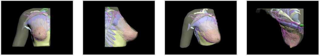 成人复杂型乳腺体模5.png