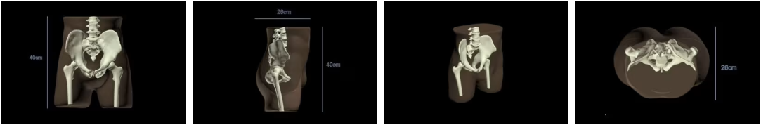 成人骨盆6.png