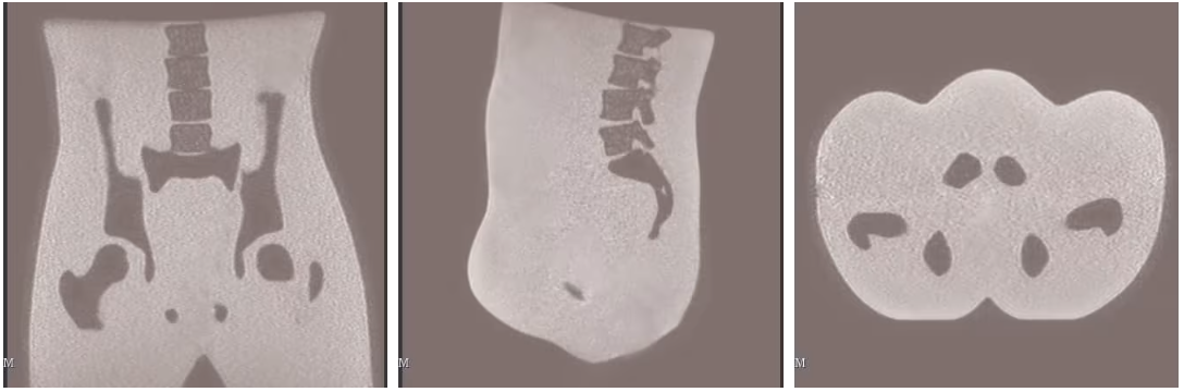 成人骨盆8.png