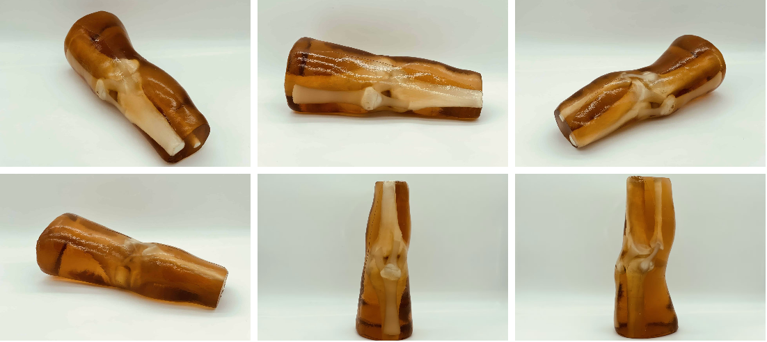 成人膝关节6.png