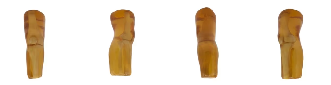 成人膝关节（仅骨骼）4.png
